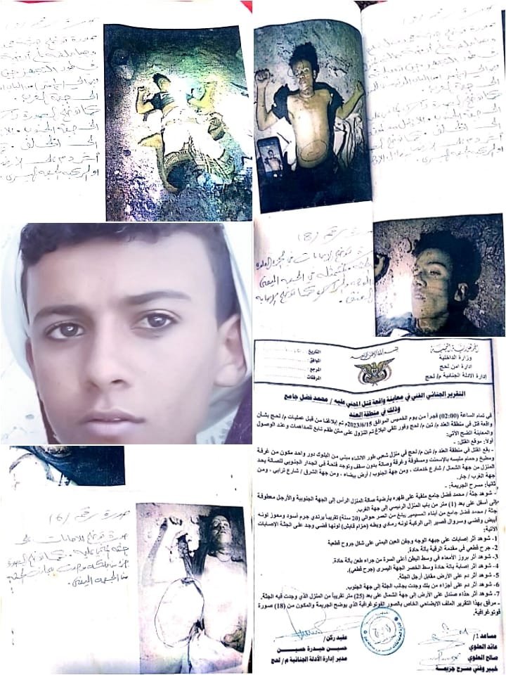 في ظل مطالبات بسرعة القصاص.. التقرير الجنائي يكشف حجم الاعتداء الوحشي والاصابات الذي تعرض له المجني عليه محمد فضل جامع الحوشبي من قبل قاتليه حتى وفاته 1 IMG 20240806 WA0089