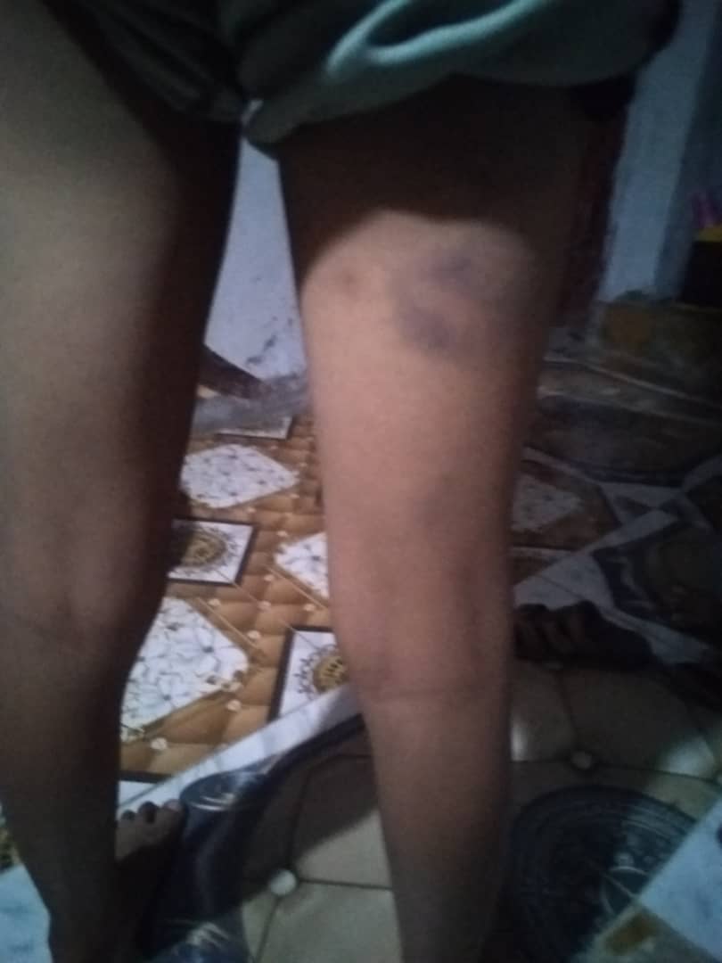 بالفيديو طفل يروي قصة تعذيبه من قبل معلمين في إحدى مدارس حجة 1 IMG 20240905 WA0036