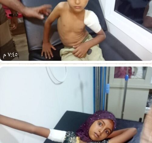 إصابة طفلين بقصف مدفعي حوثي على منازل المواطنين في حيس 1 photo 5990279712406094728 x