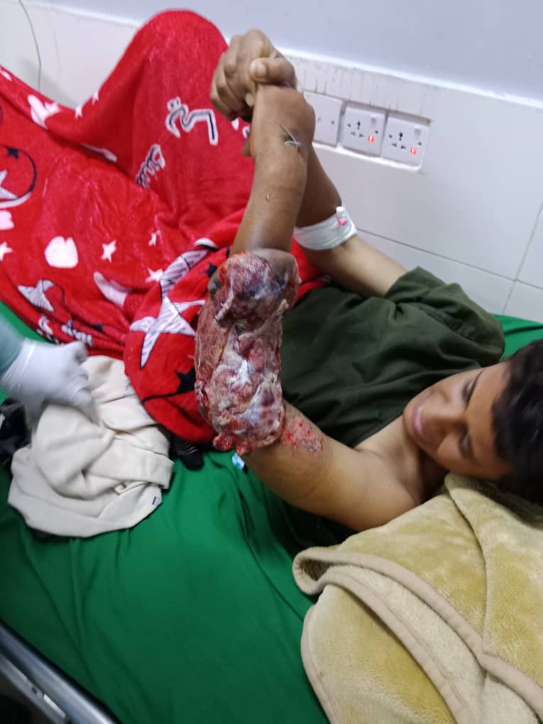 انتهاكات المليشيات .. ضحايا أطفال جراء انتهاكات حوثية في يافع (صور) 1 ضحايا أطفال جراء انتهاكات حوثية في يافع