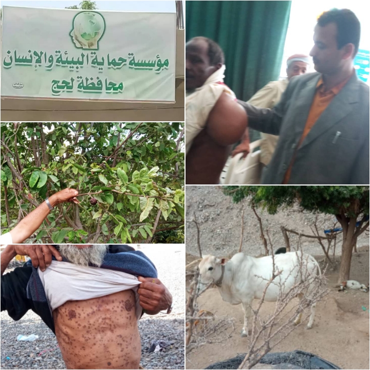 أبناء المسيمير الحواشب: نتعرض لحرب إبادة جماعية وتدمير ممنهج لكل أشكال الحياة من قبل مصنع أسمنت الوطنية 1 IMG 20241024 WA0092