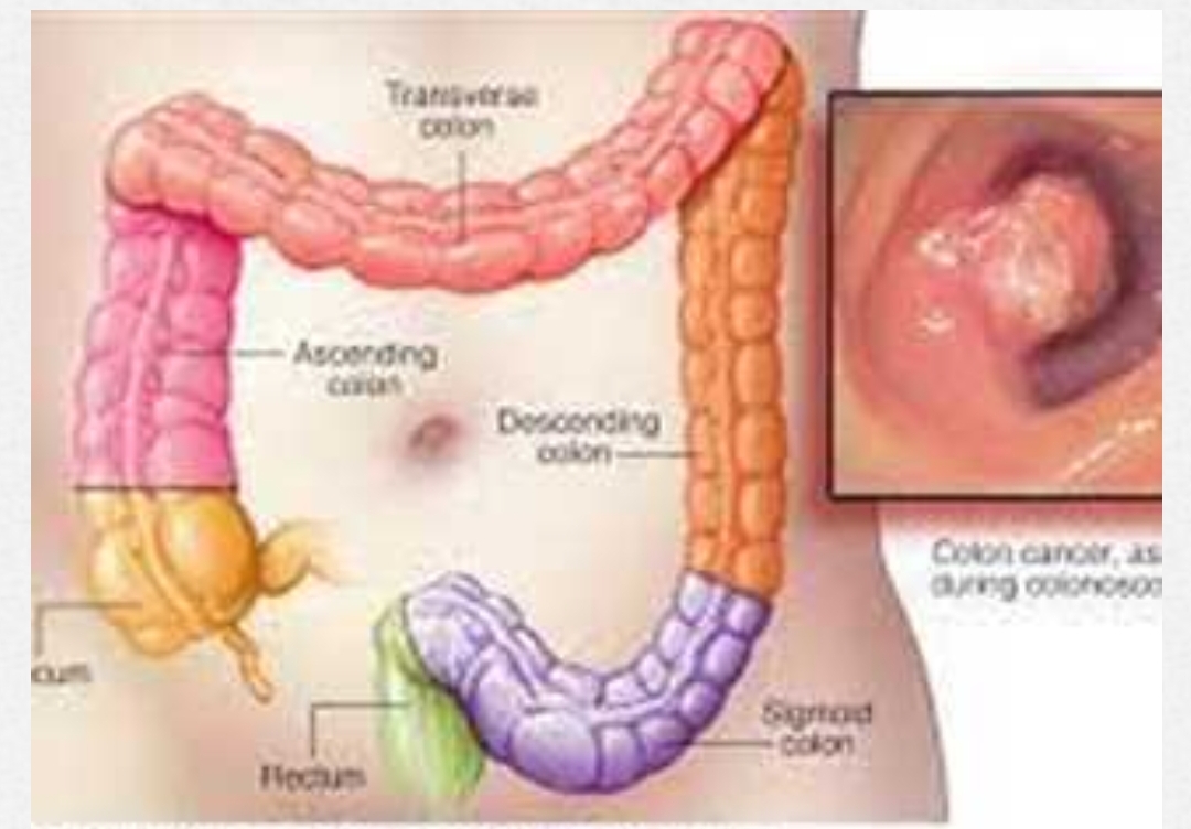 Screenshot ٢٠٢٤ ١٠ ٠٦ ٠٧ ٢٦ ٠١ ٧٢٤ com.ajjel .news edit