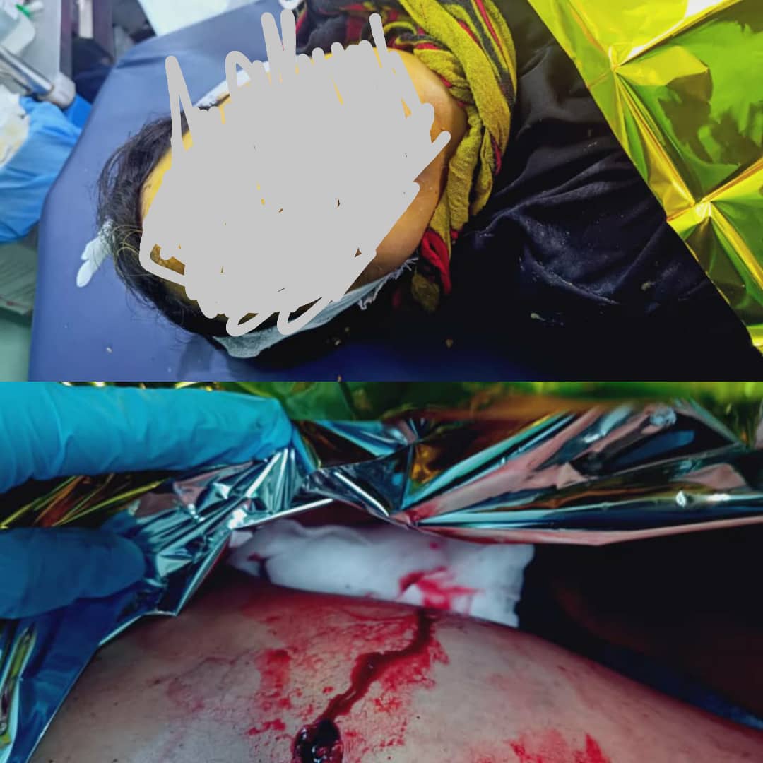 استشهاد إمرأة برصاص مليشيات الحوثي في قعطبة شمال الضالع .. 1 IMG 20241105 WA0090