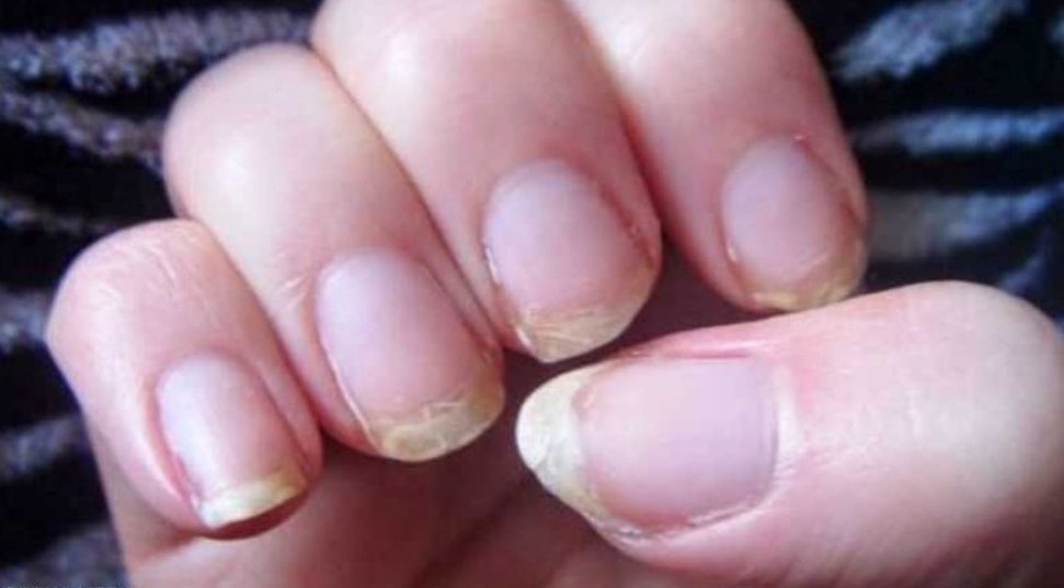 IMG ٢٠٢٤١١٢٠ ١٦٣٤٥٧