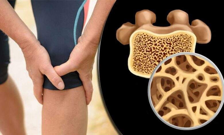 اكتشف أسباب هشاشة العظام وكيفية الوقاية منها 1
