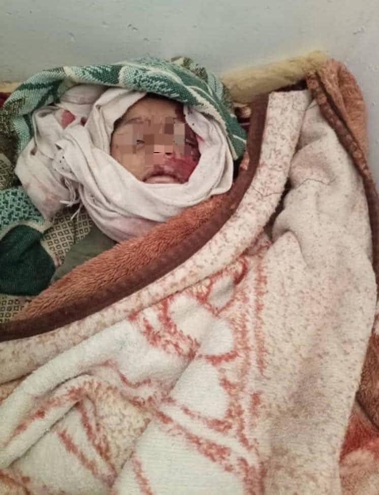 تعز: وفاة طفل بسبب ازدحام خلف سيارة نقل مياه في مشرعة وحدنان جراء أزمة عطش خانقة 1 IMG 20250724 WA0006