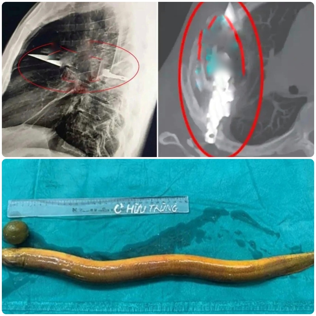 CYMERA ٢٠٢٥٠٨١٥ ٠٠٣٨١٩ 01