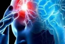 تحفيز الدماغ.. تقنية جديدة لعلاج الصرع غير المستجيب للأدوية 6 202112060357385738 1