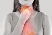 لمرضى الارتجاع.. هذا المشروب الصحى في قائمة الممنوعات الأساسية 6 201905121211331133