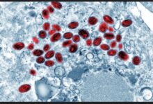 إصابة ثلاث حالات في كاليفورنيا بفيروس "معقد"، يثير الرعب في الولايات المتحدة وأوروبا (لاتفوّت التفاصيل) 7 Screenshot ٢٠٢٥ ١١ ٠٤ ٠٤ ٤٢ ٢٦ ٦٣٦ com.word .ajjel edit