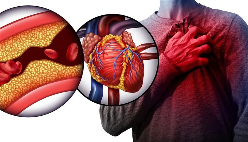 أعراض للنوبة القلبية تظهر قبل أسابيع من حدوثها ( تفاصيل ) 1 2025123151337377OA