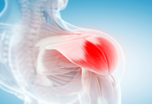 6981db2c4c59b76797744101