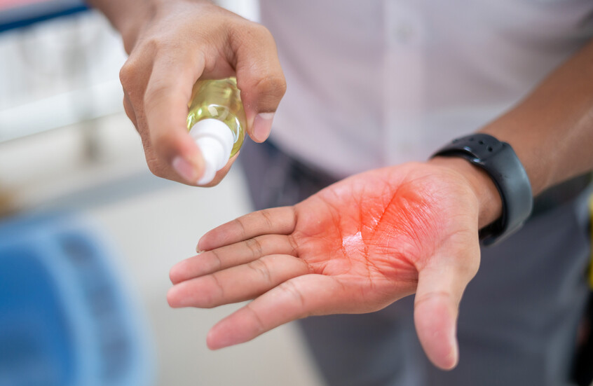 قد ينقذ آلاف الأرواح من النزيف المميت .. علماء يطورون رذاذا ثوريا يغلق الجروح في جزء من الثانية 1 6989d75a4c59b75a29436dfe