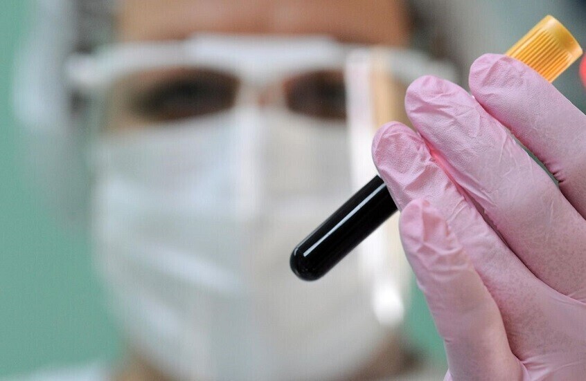 مخاوف من جائحة جديدة بعد اكتشاف فيروس "صامت" يخترق الجهاز التنفسي للبشر 1 699d73214c59b70d8f681fc0