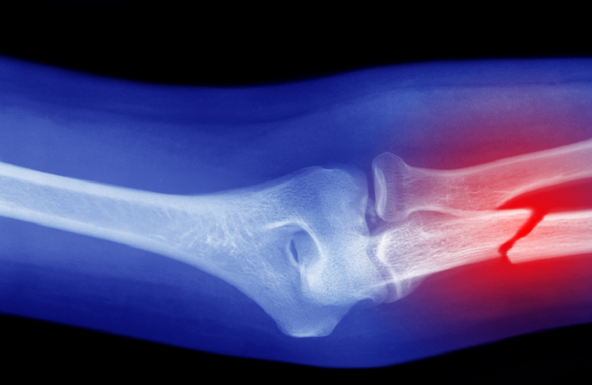 69b164f04c59b7689e7fed27