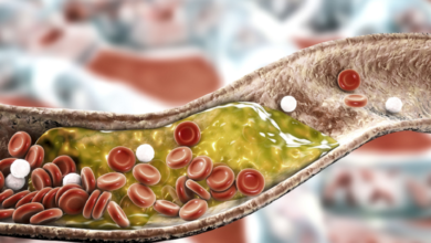 69cfd7204236040a2b61ad94