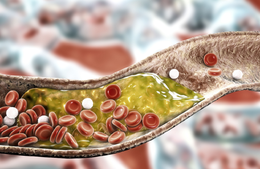 69cfd7204236040a2b61ad94