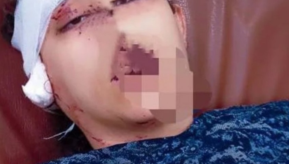 IMG ٢٠٢٦٠٤٢٨ ٢٠٤١٥٢