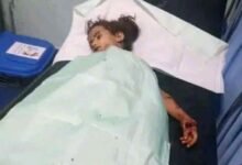 فاجعة في الضالع .. جسم متفجر يحصد أرواح أطفال ويصيب آخرين في حجر 8 img 33